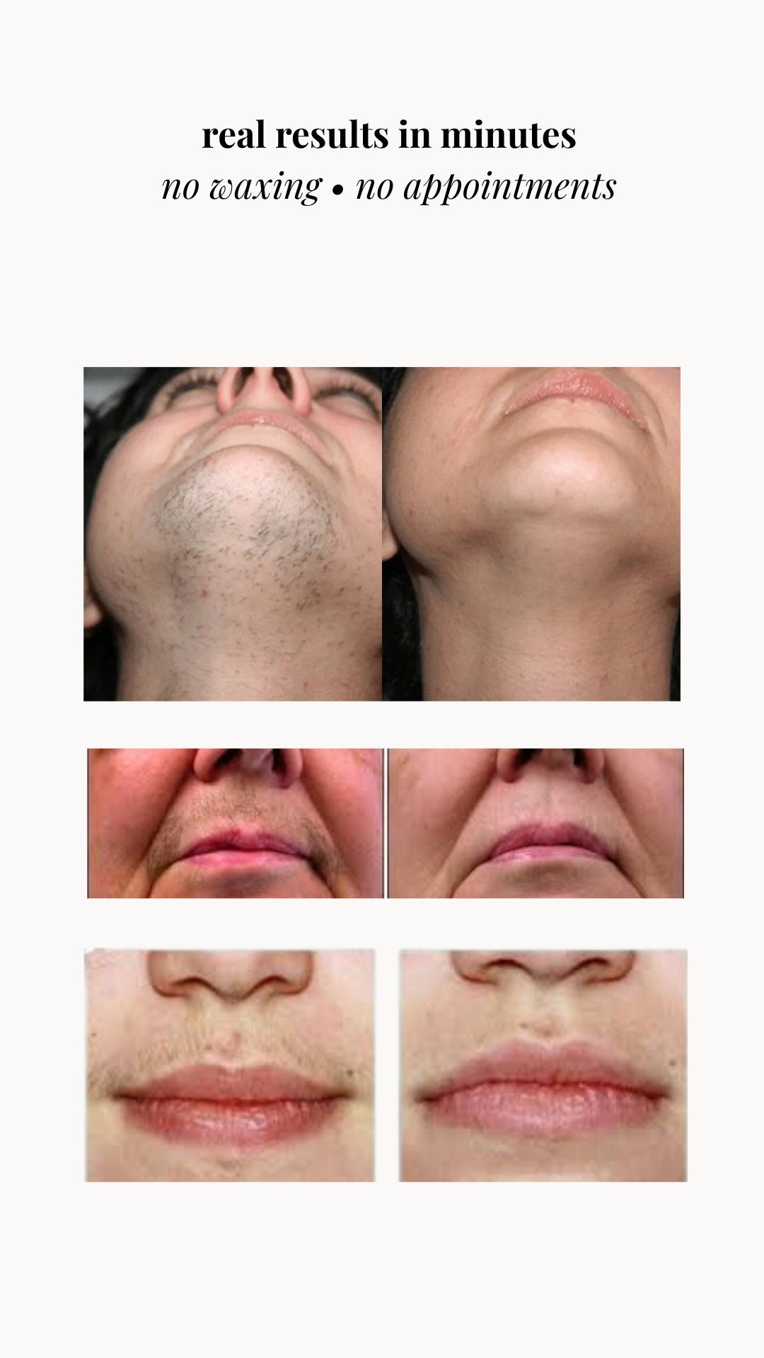 Soft Reset Peach Fuzz Eraser